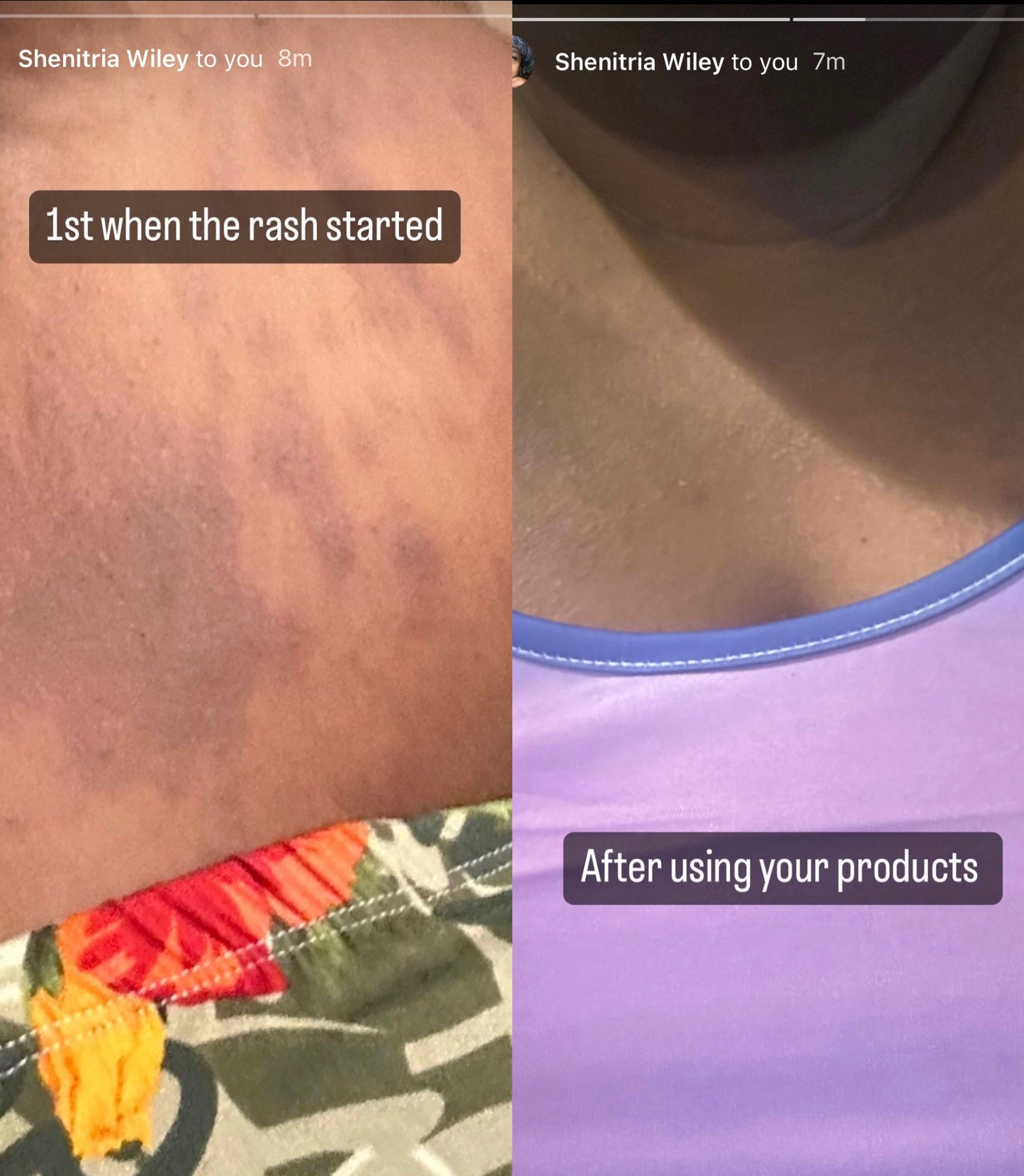 Kojic Acid + Turmeric Body Wash (Sensitive Skin)